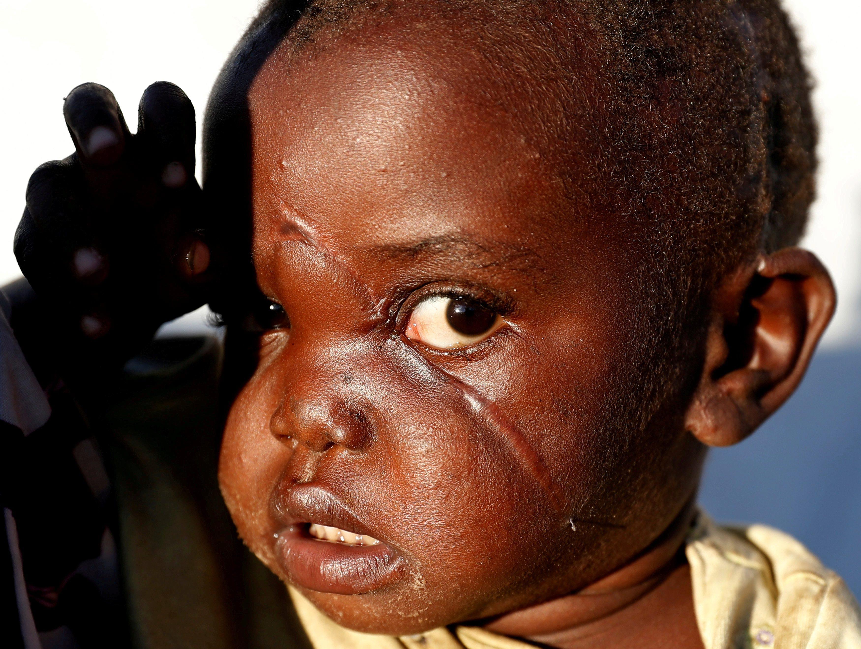 A Picture and its Story: Inside the Congo camp haunted by an unknown war