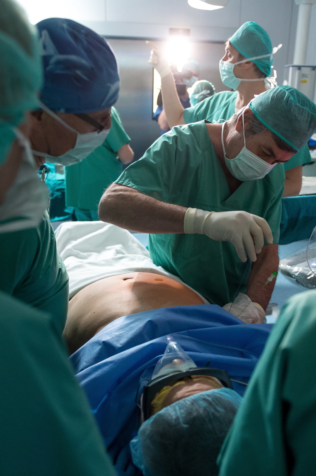 Operacja złośliwego guza wątroby przy użyciu echolasera, przeprowadzona przez polski zespół i włoskiego operatora Giovanniego Giuseppe Di Costanzo