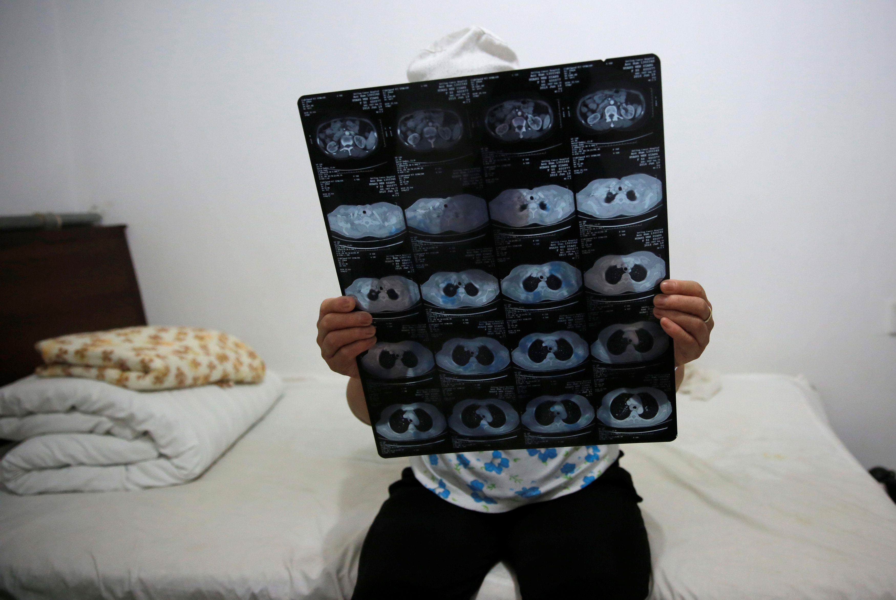 The Wider Image: China's cancer patients far from home