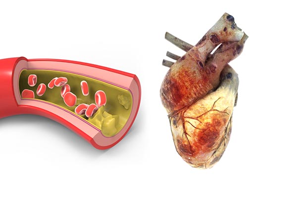 biológia betegség egészség szív tüdőtranszplantációban