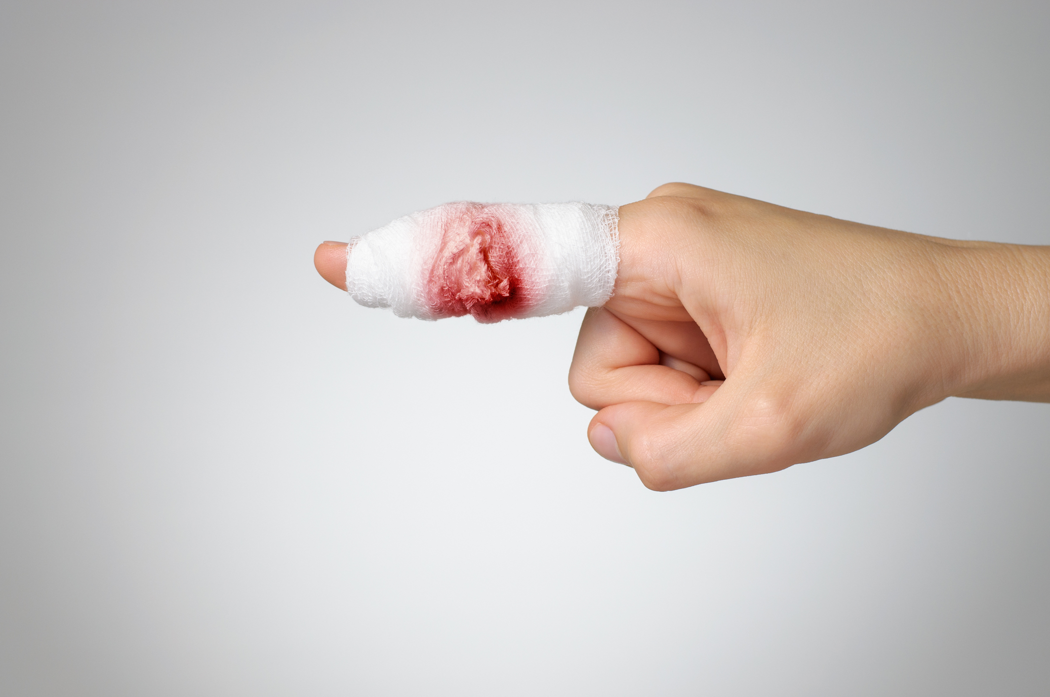 Horrorsérülés: A jegygyűrűje csonkította meg a focista ujját - Fotó (18+) -  Blikk