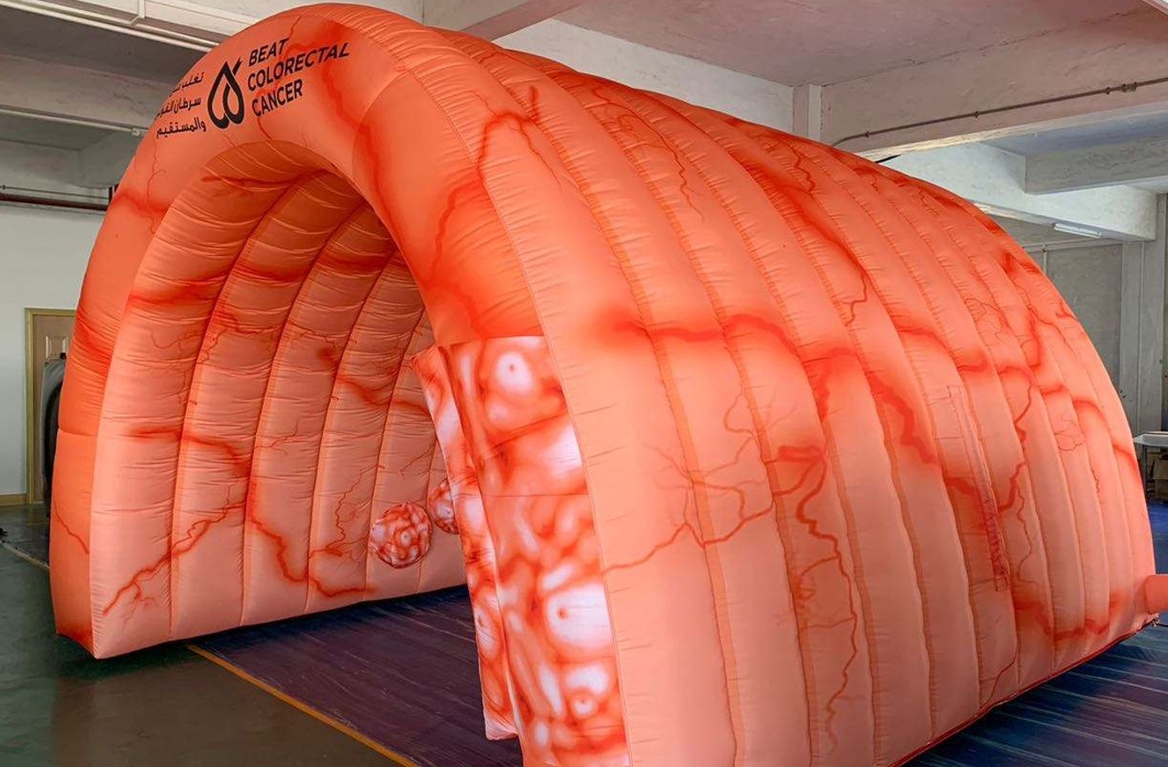 Több tízezer embert diagnosztizálnak évente vastagbélrákkal itthon – Vajon megelőzhető lenne?