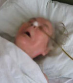 83 éves nő vaginájába szorult a borotvahab doboza - Blikk
