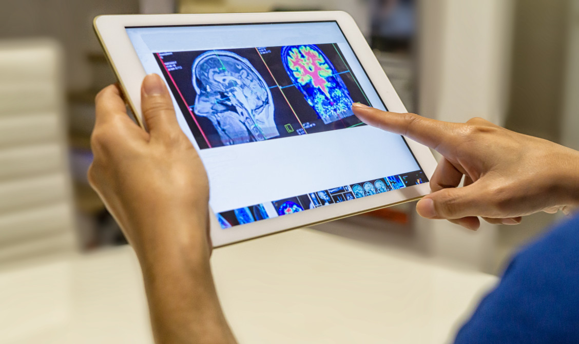 Új módszert kísérleteztek ki itthon az epilepszia kezelésére