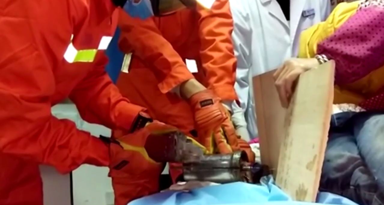 Horror: húsdarálóba szorult a kislány keze, bedarálta az ujjait - 18+videó  - Blikk