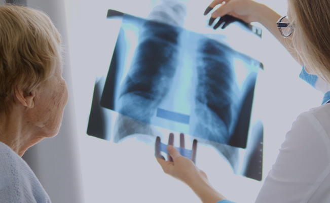 Észrevette magán ezt a furcsa tünetet? Akár egy ritka betegség, tüdőfibrózis is lehet!