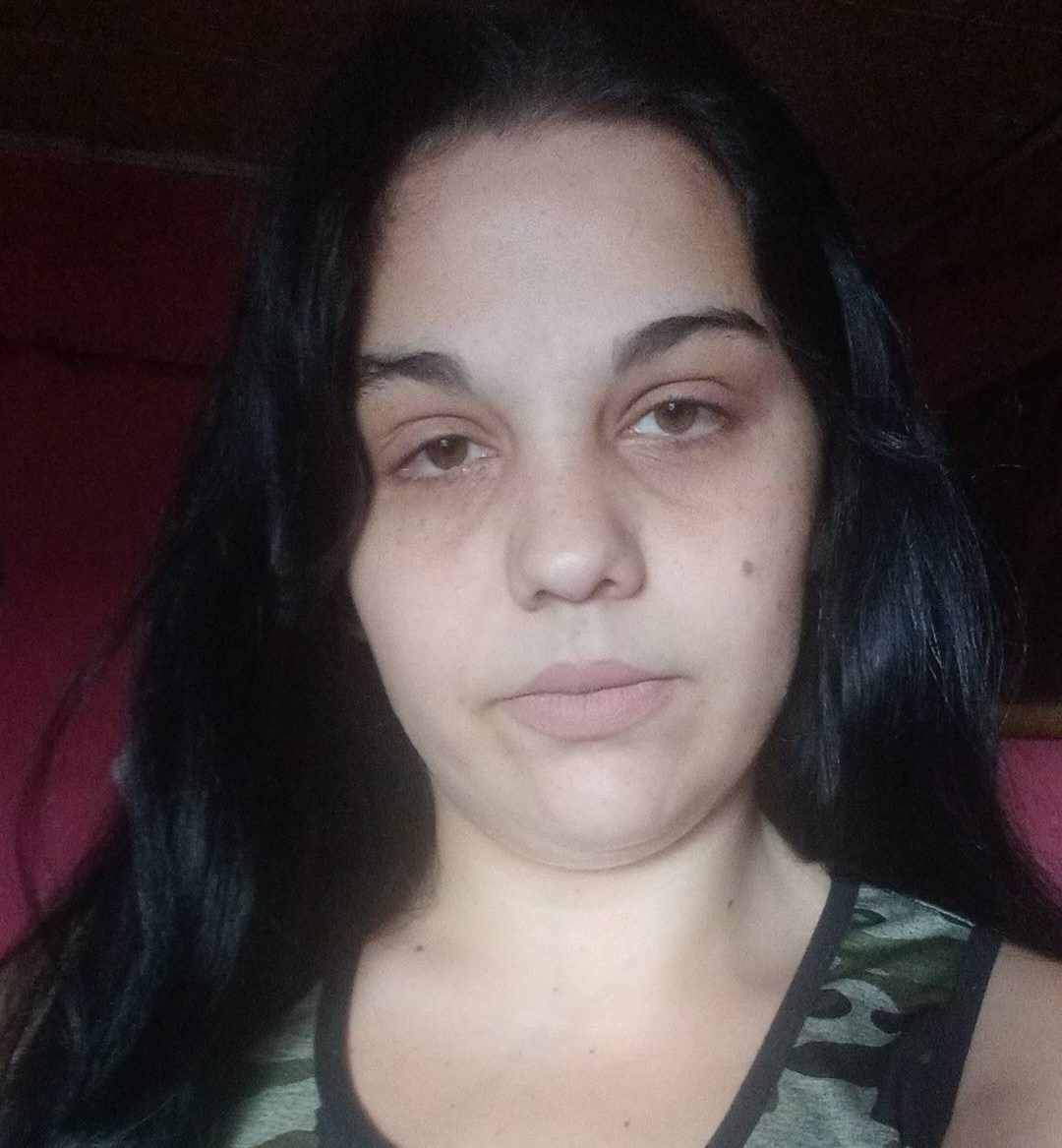 „Nem is láthattam a halott babámat” – Andreát elaltatták, megcsászározták, majd közölték vele, a kisfia már nem él