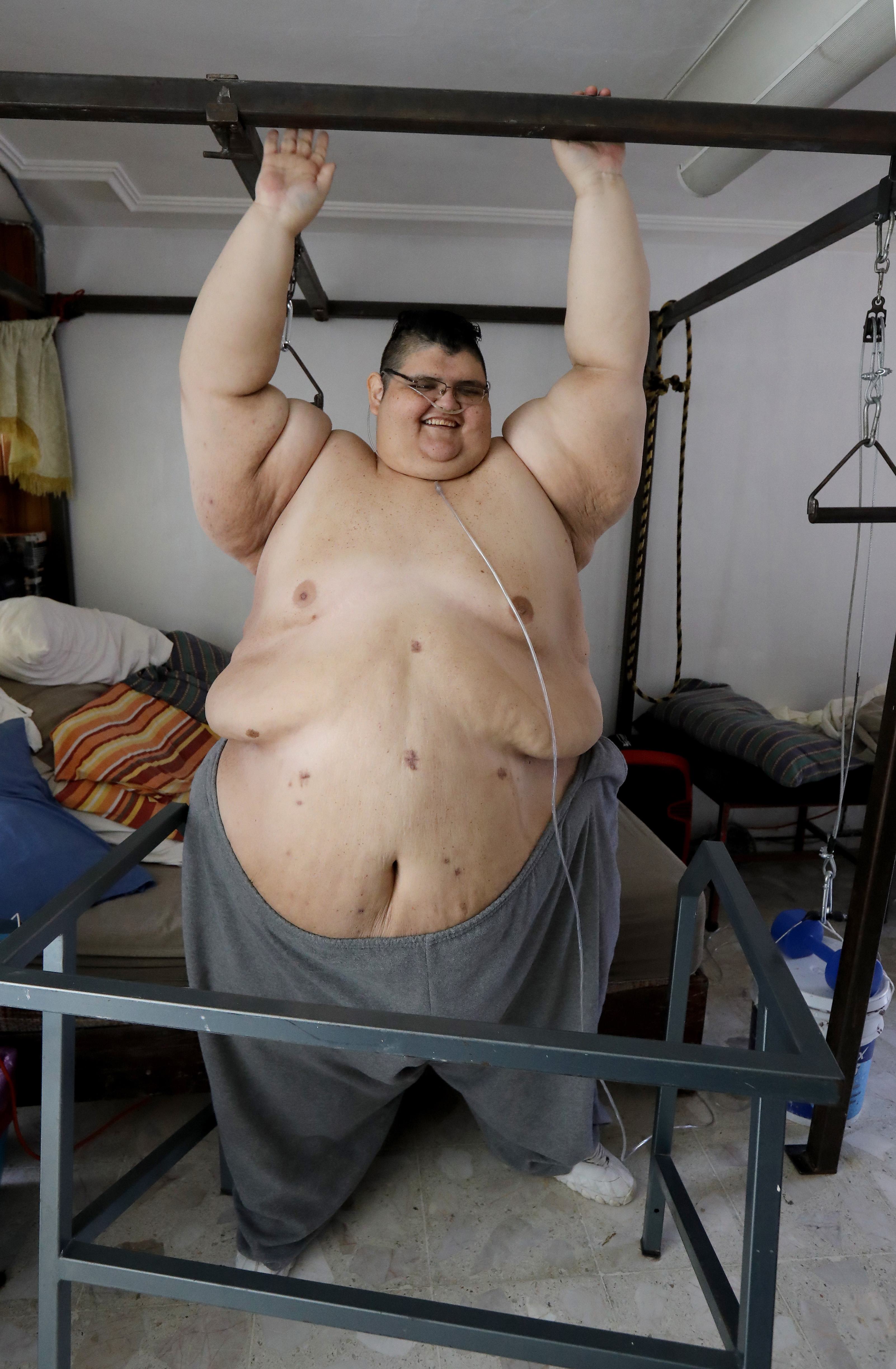 Megdöbbentő! Borzasztóan néz ki a világ legkövérebb embere! – fotóval! | Well&fit