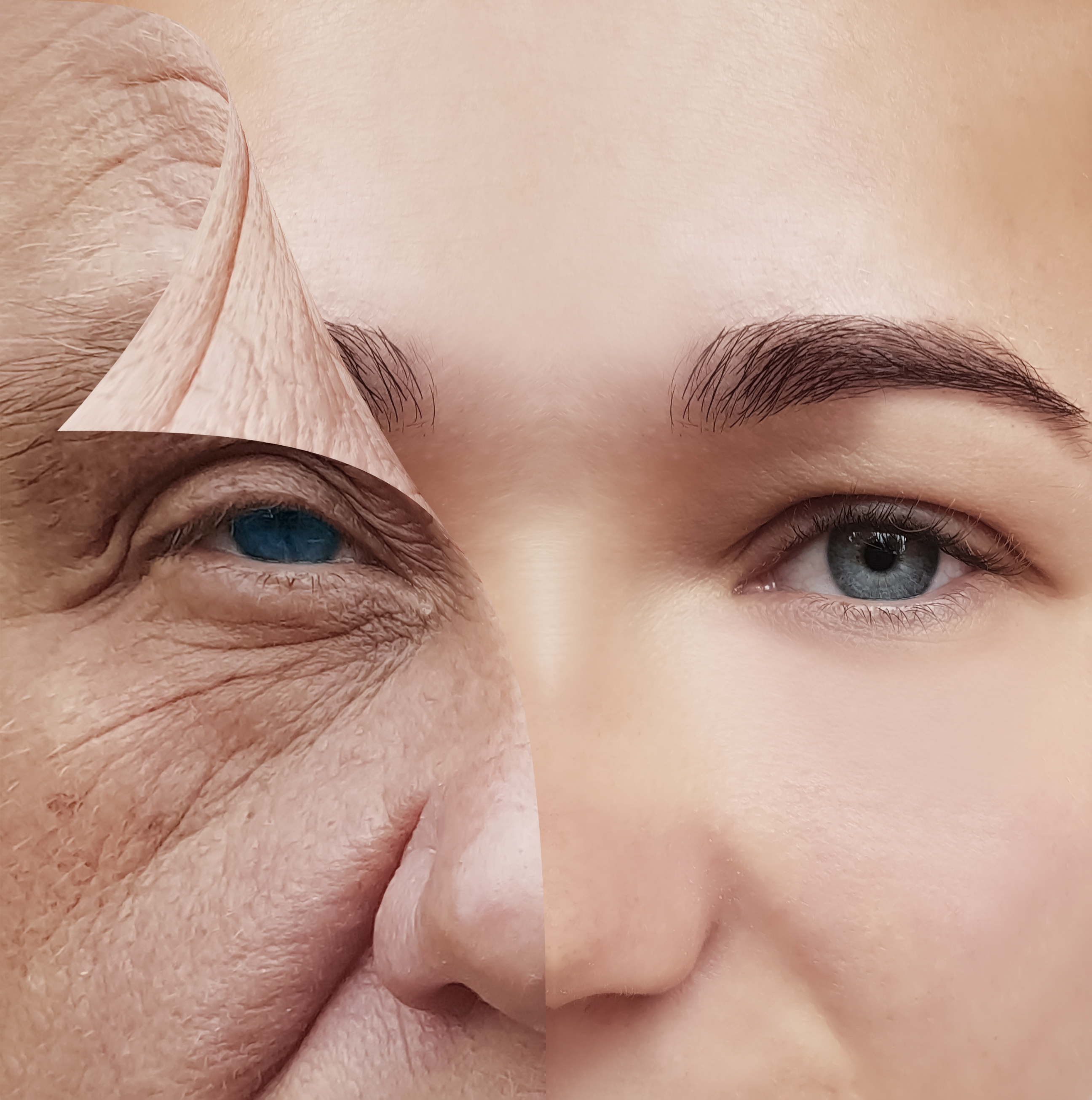 Milyen élelmiszerek jók a ráncok ellen? A leghatékonyabb anti-aging ételek