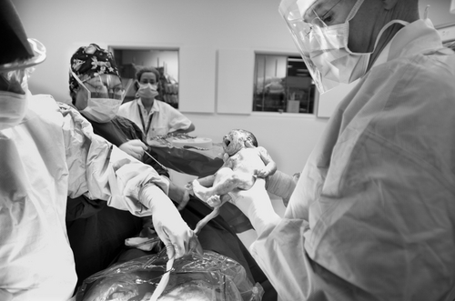 Emergency C-section risks stillbirth