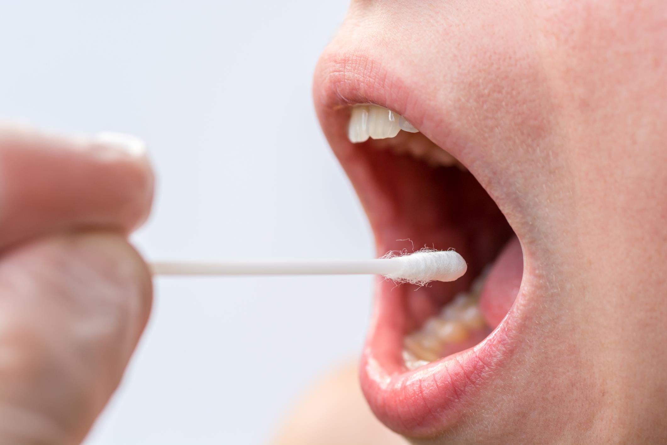 Choroby Jamy Ustnej Przyczyny Objawy I Leczenie Budowa I Funkcje Hot