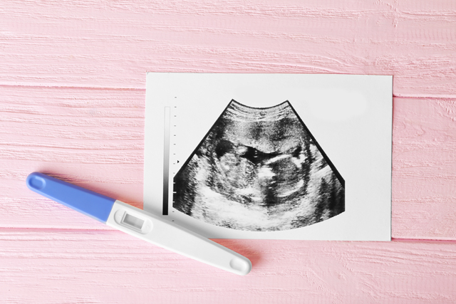 5 dolog, amit mindenképpen tudnod kell a terhességi tesztekről - Glamour