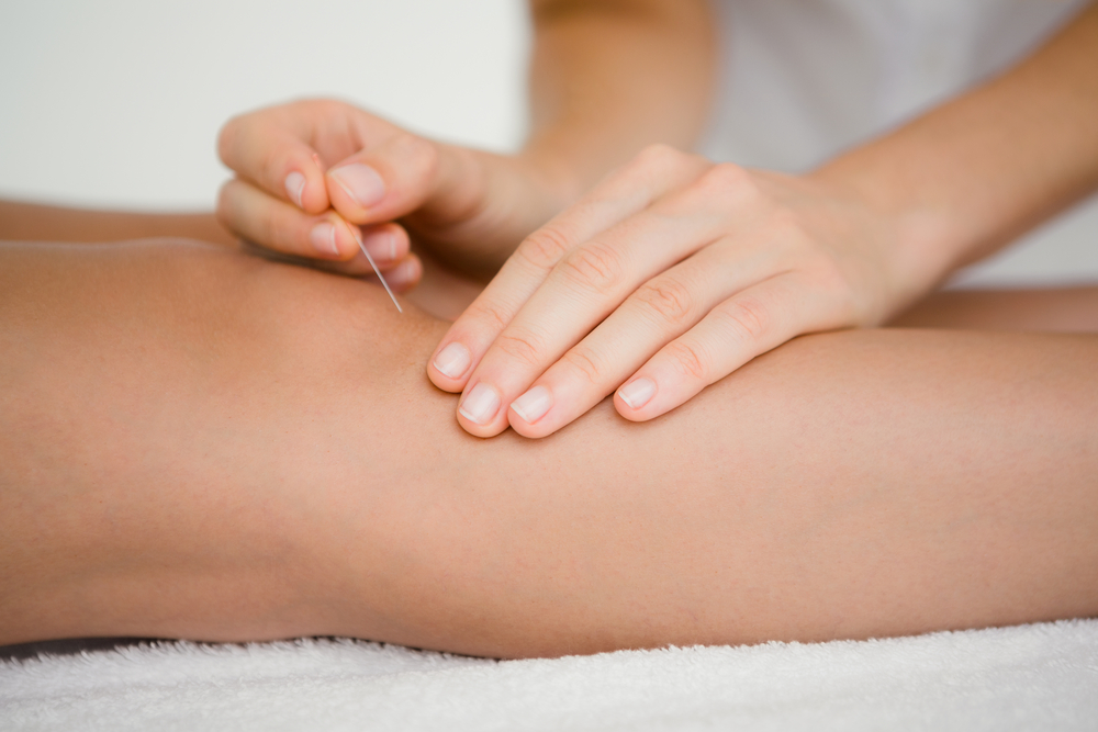 az akupunktúra segít az ízületi fájdalmak kezelésében