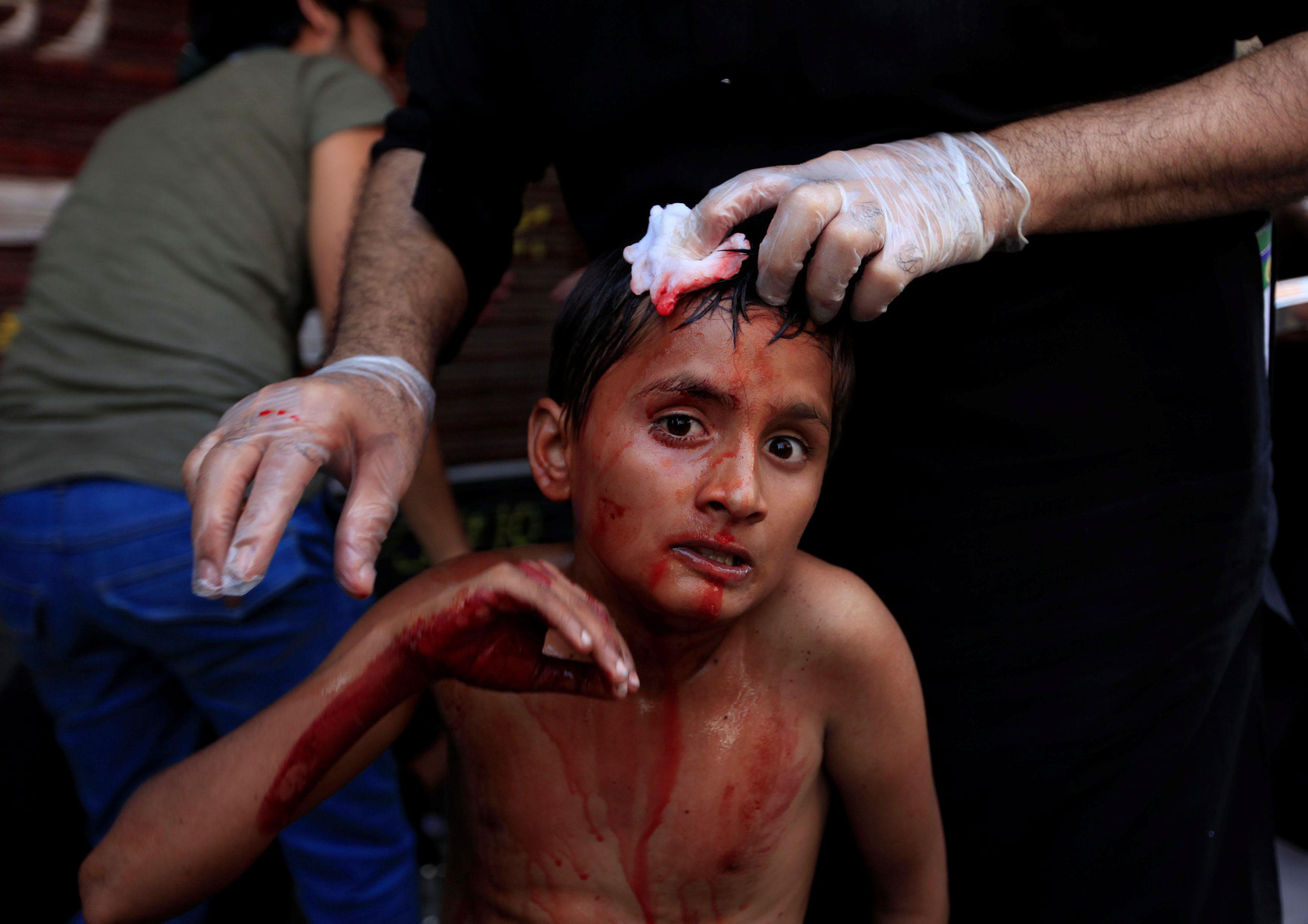 A paramedic attends to a Pakistani Shi'ite Muslim boy after he flagellated himself during a religiou