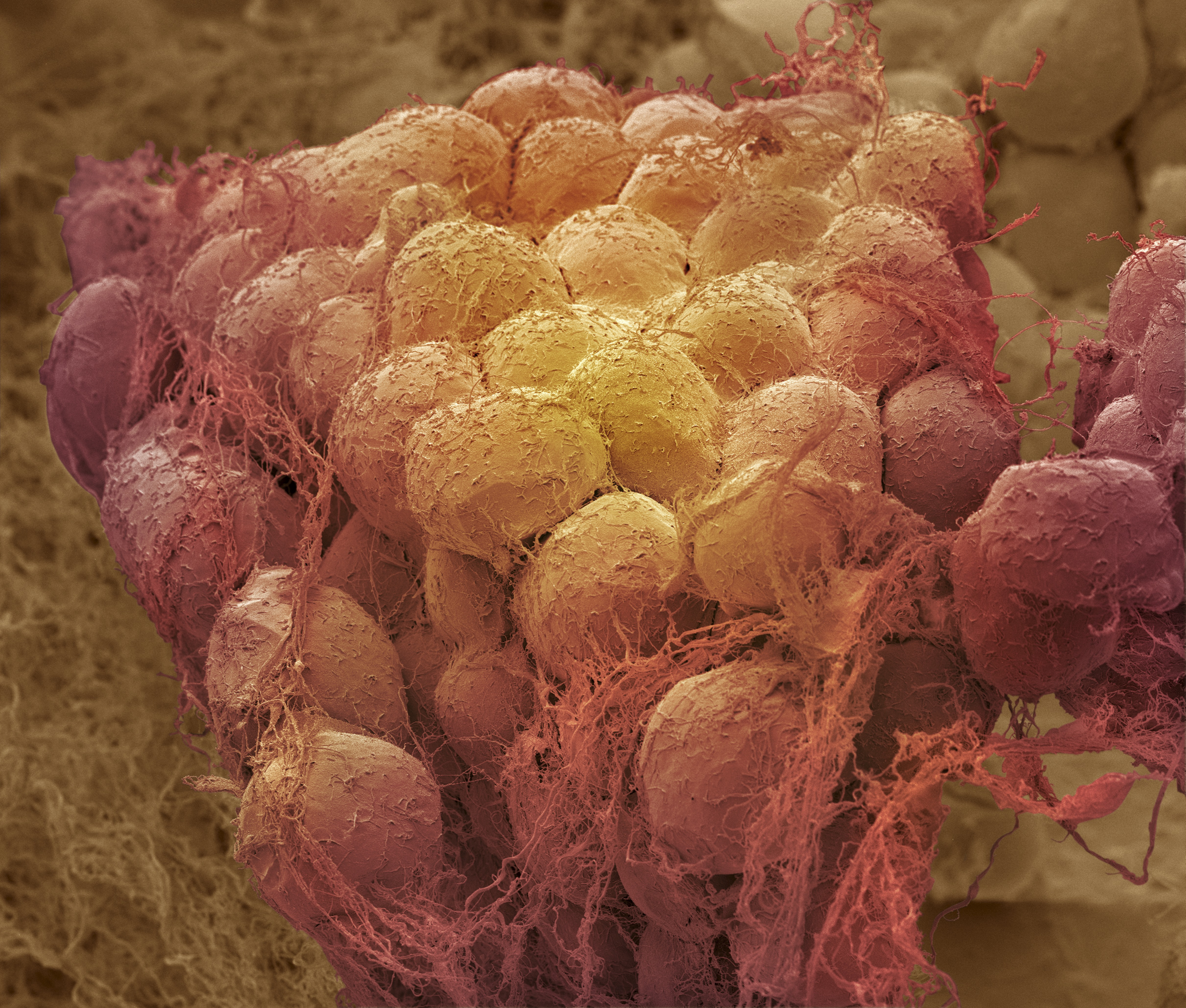 Komórki tłuszczowe (adipocyty, czerwono-żółte)otoczone drobnymi pasmami tkanki łącznej.