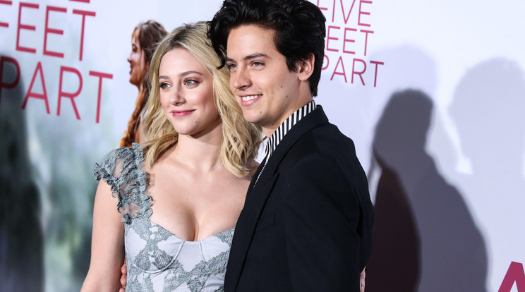 Kellemetlen betegséggel diagnosztizáltak a Riverdale csodaszép sztárját: Will Smith felesége is ebben szenved alopeciával szenved