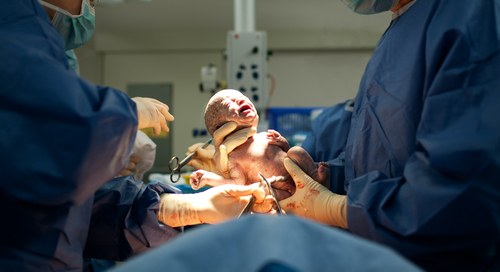 There are several reasons why an emergency caesarean section might take place