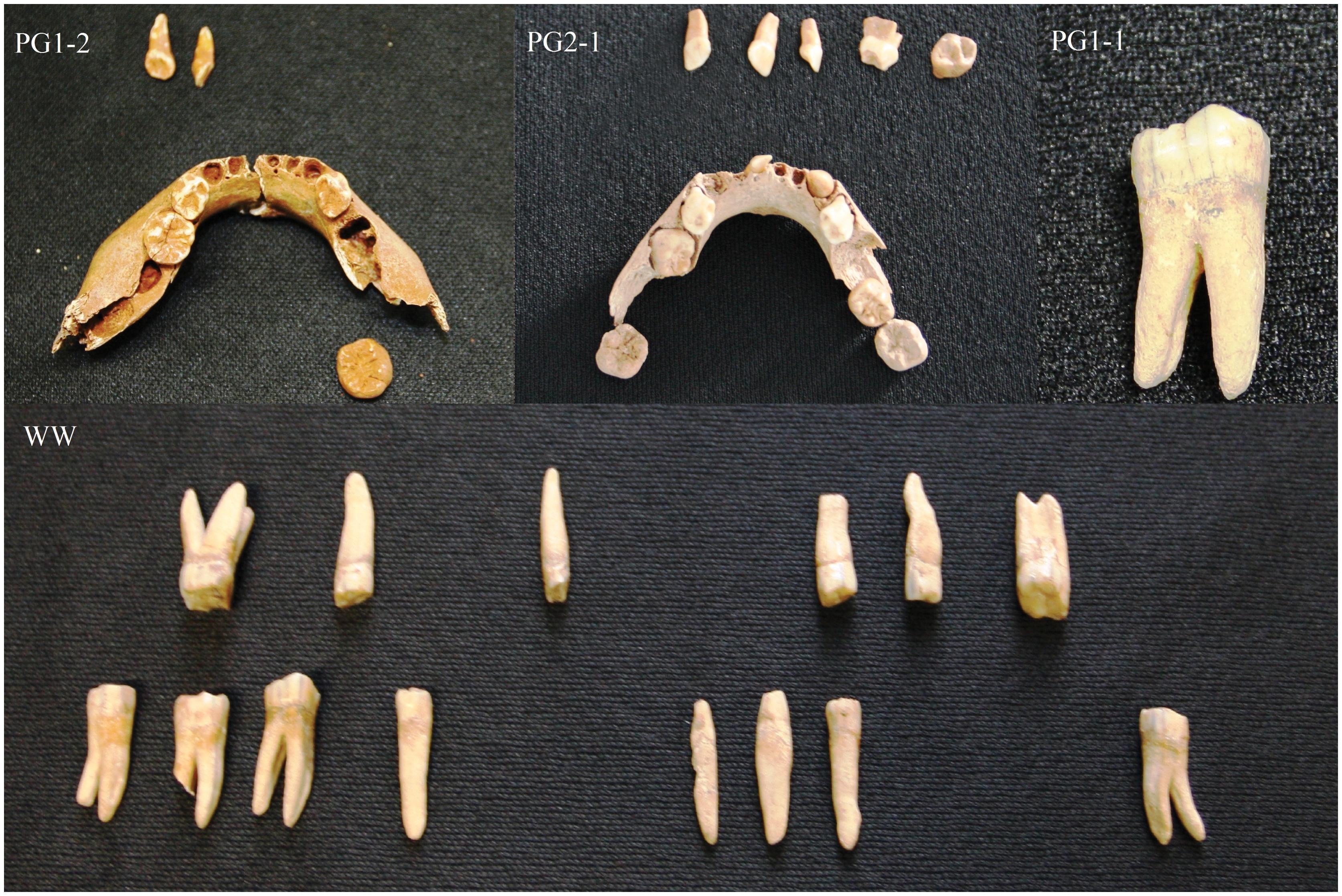 Zęby z mezolitycznych stanowisk archeologicznych: PG1-2: zęby trzyletniego dziecka; PG2-1: szczęka półtorarocznego dziecka; PG1-1: ząb osoby dorosłej z Pierkunowa-Giżycka; WW: znaleziska z Woźnej Wsi.