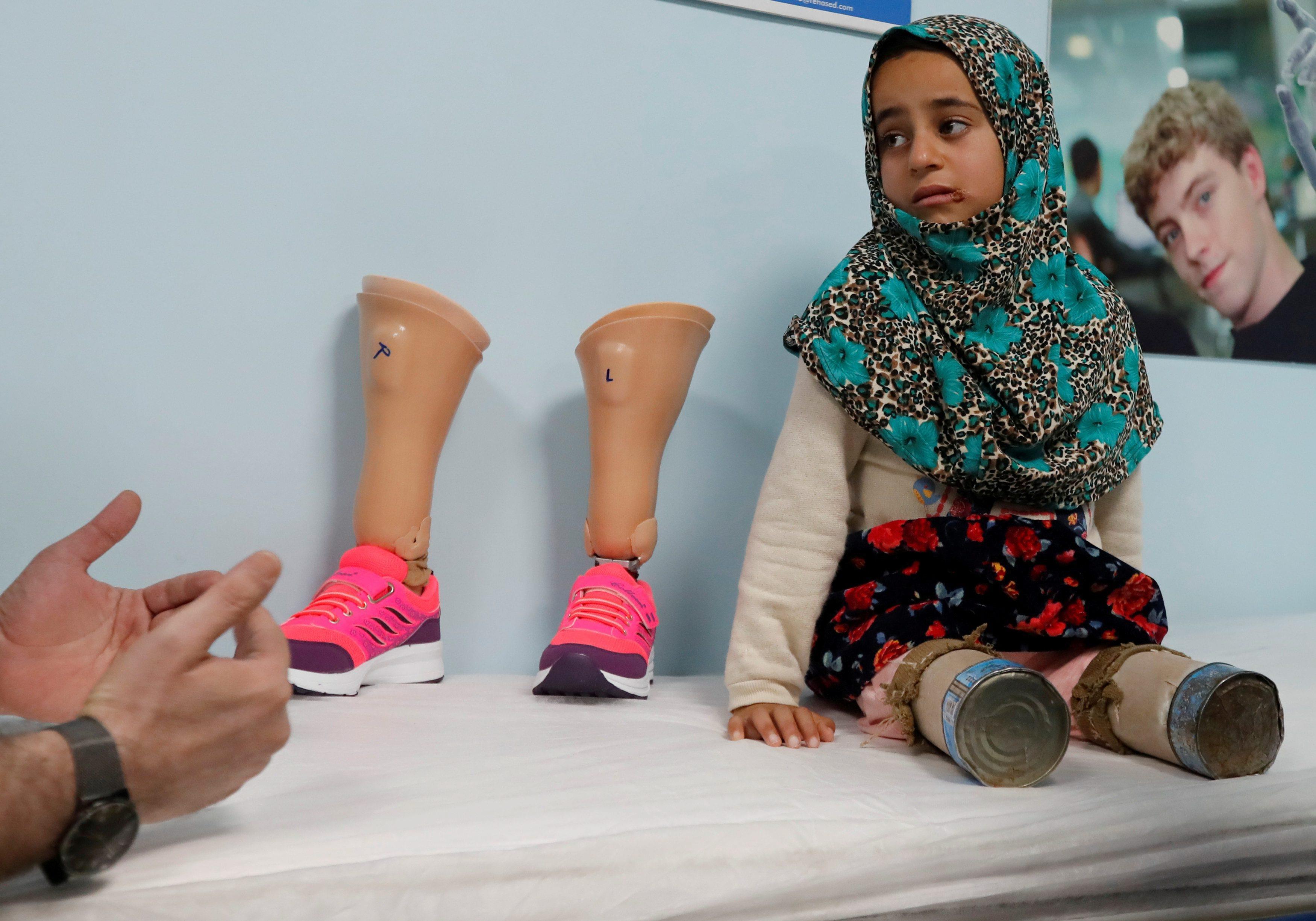 Maya Meri waits at a prosthetic center in Istanbul