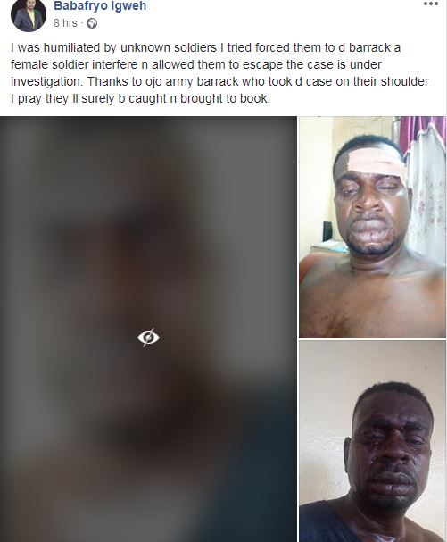 Baba Fryo is presently nursing injuries sustained after he was allegedly beaten by men of the Nigeria Army [Facebook/BabaFryoIgweh]