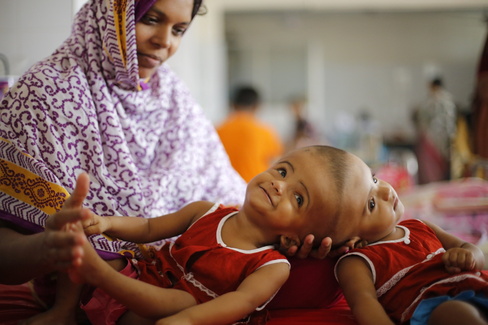 Rabeya Islam i Rokeya Islam leżą w szpitalu w stolicy Bangladeszu, Dhace. Czuwa przy nich ich mama, Taslima Khatun, z zawodu nauczycielka. Kobieta jest dobrej myśli i wierzy, że chirurgom uda się bez szwanku rozdzielić jej córki.