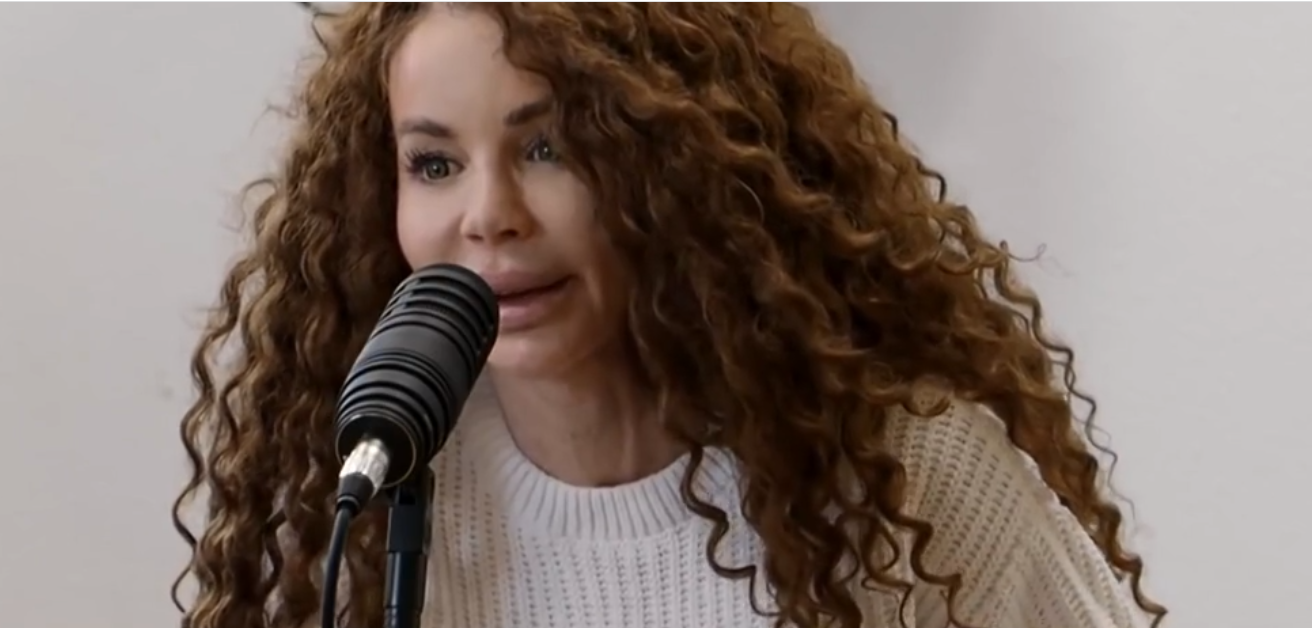 Mit csinált magával? Felismerhetetlenné műttette az arcát Keleti Györgyi