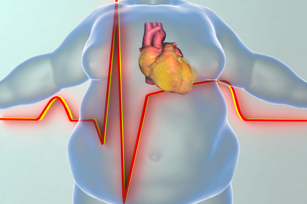 22 Szívbetegségek/Heart Disease ideas | vérző szív, ebéd gyerekeknek, trópusi gyümölcs