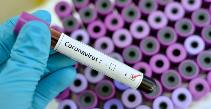 Ekiti is one of the states where coronavirus cases have been confirmed. (Pulse)