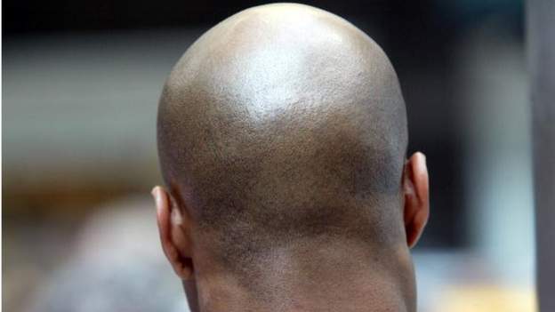 Calling a man \'bald\' is sexual harassment – Court rules