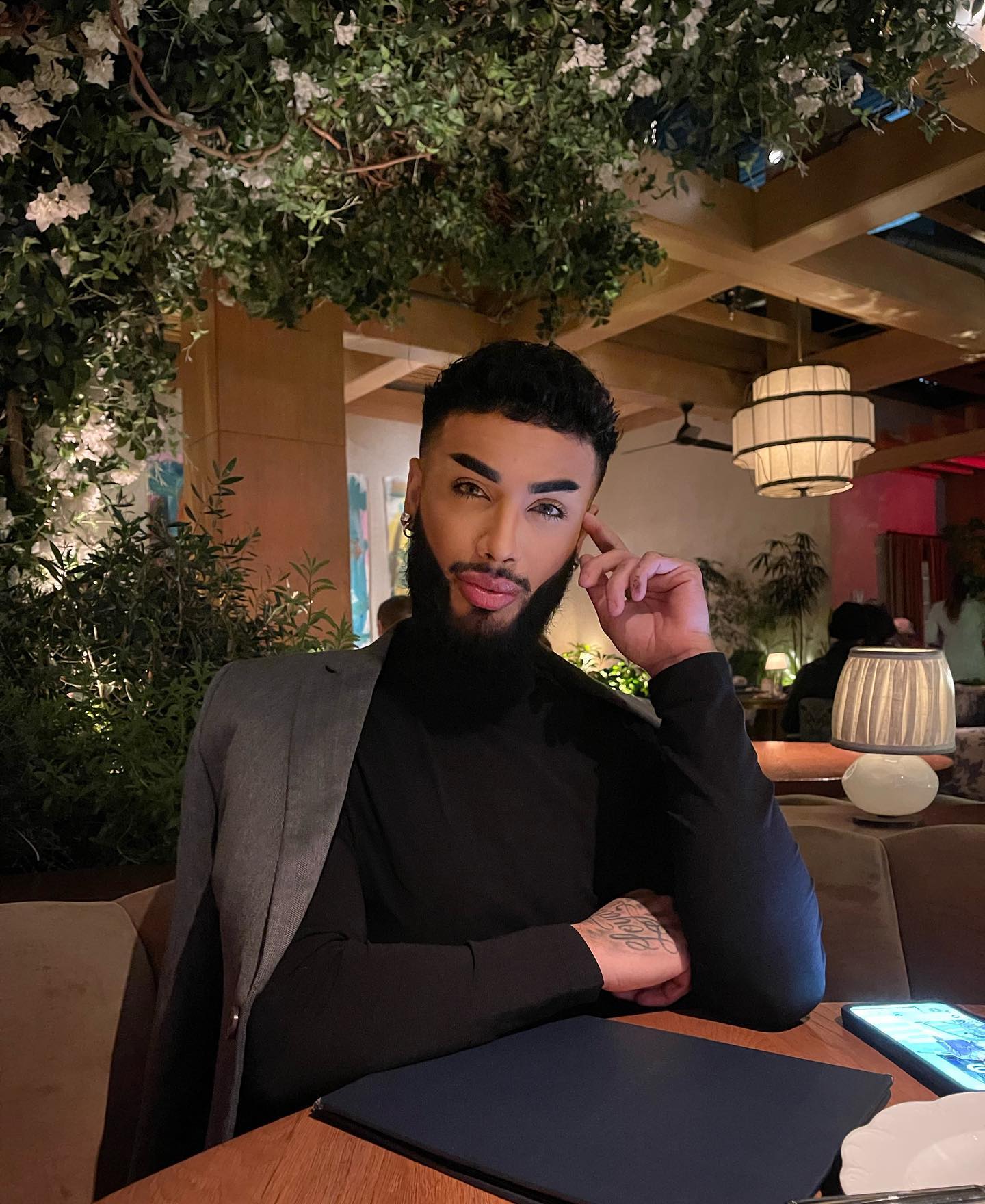 Mindenáron Nicki Minaj-féle óriásfeneket akar ez a férfi, már egy vagyont költött a plasztikázásra - itt vannak a fotók