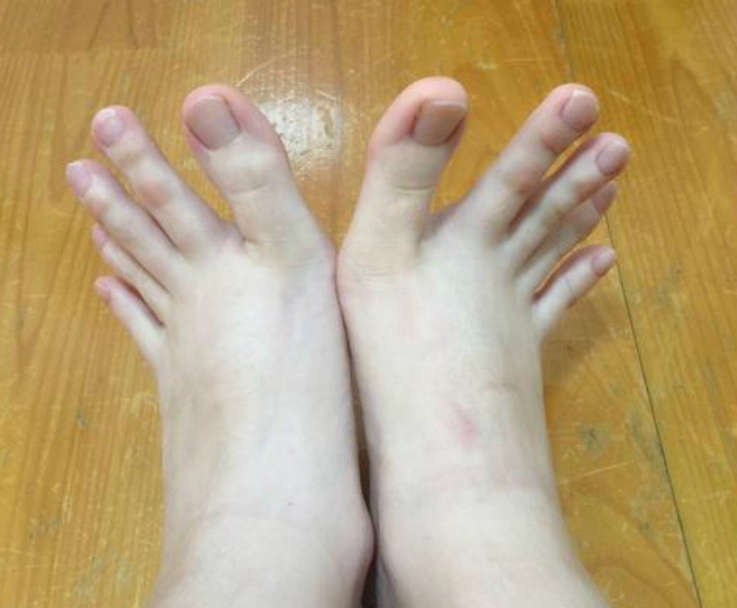 Visoka je samo 151 cm, ali prsti na nogama su joj toliko dugački da ih  koristi kao one na rukama! - Žena.rs