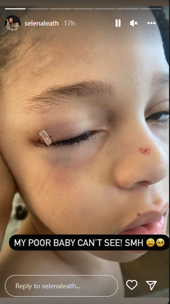 Runtown's son suffers eye injury