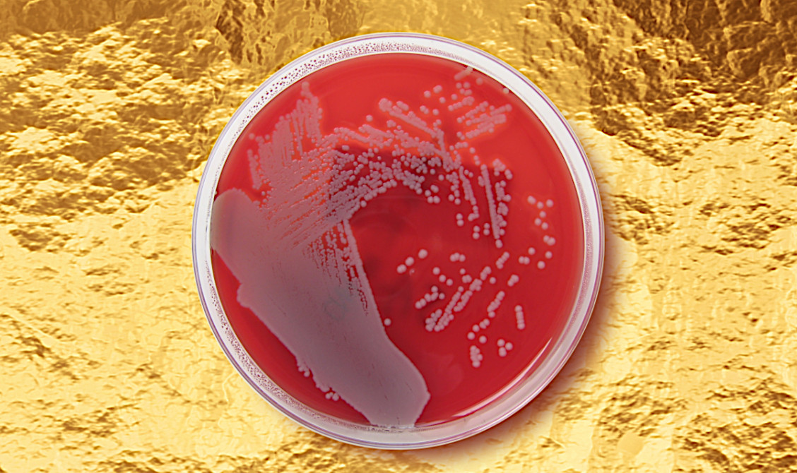 Ezek a jövő antibiotikumai: tényleg az arany fog megmenteni bennünket a leghalálosabb baktériumoktól?