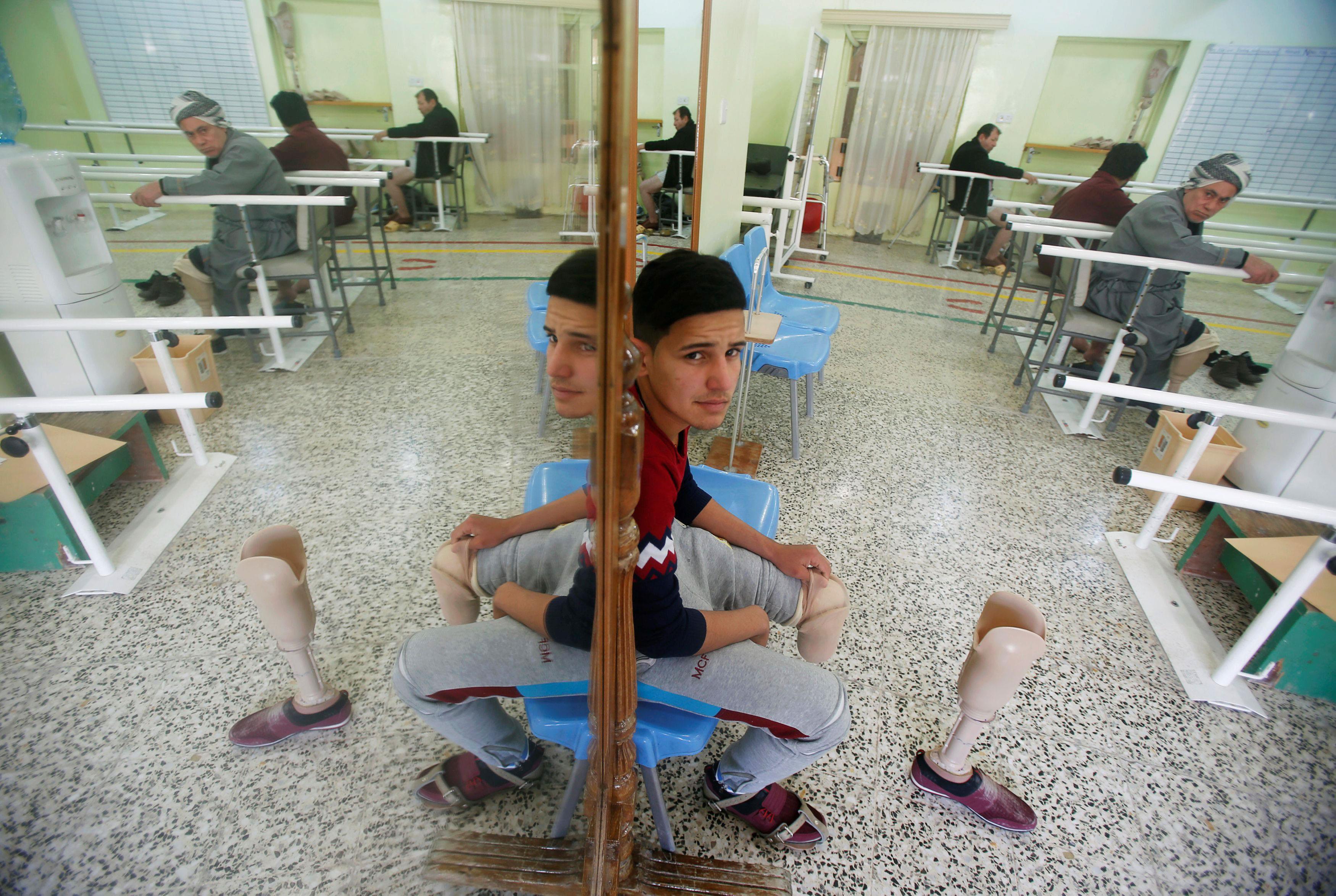 Iraqi Ahmed, 16, who lost his leg during the fighting in Mosul, attends a physiotherapy session in E