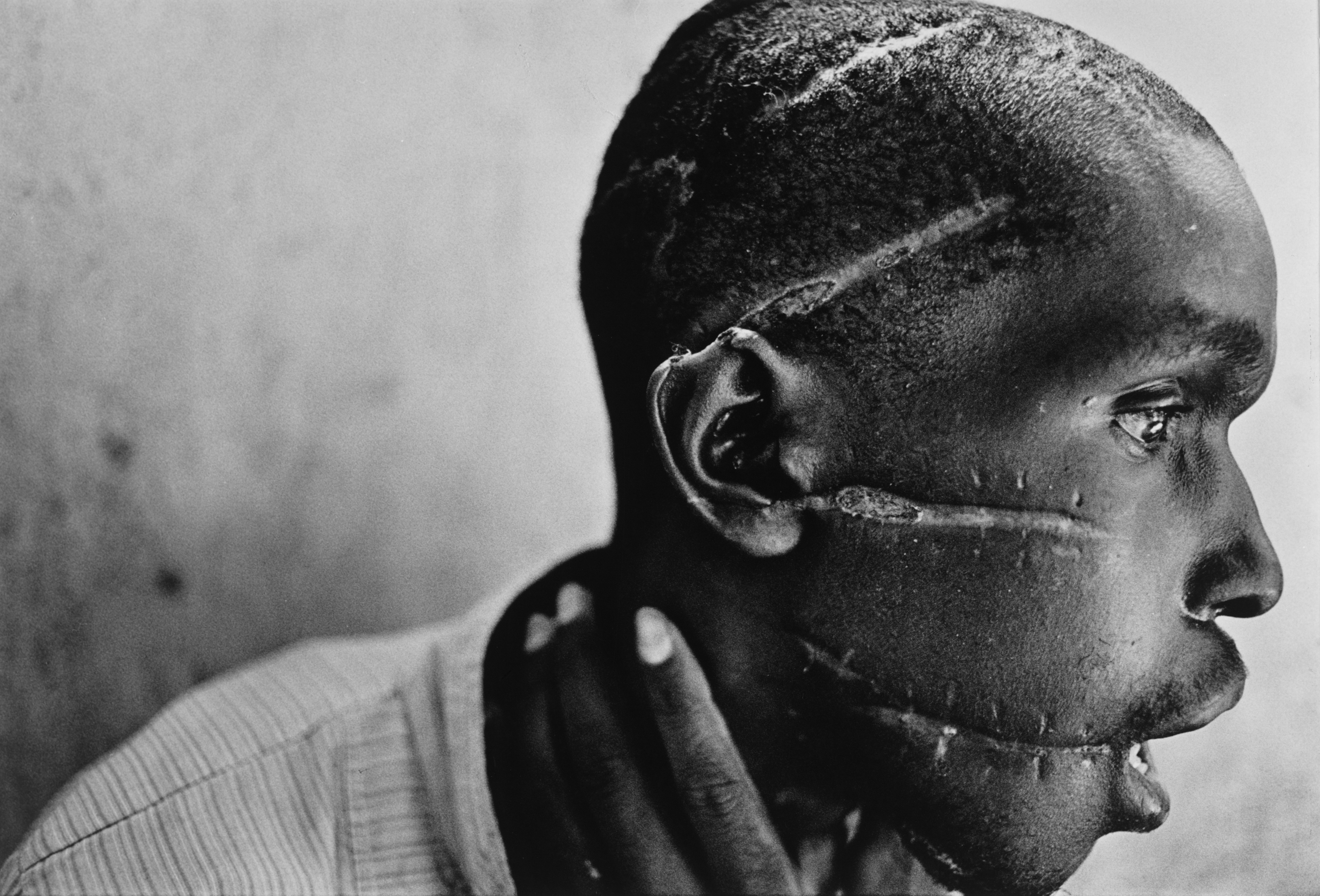 W około 100 dni 1994 roku w Rwandzie życie straciło mniej więcej milion ludzi - członków plemienia Tutsi zamordowanych przez Hutu, oraz Hutu podejrzewanych o sprzyjanie bądź chronienie Tutsi. Skala ludobójstwa była niespotykana. Bratobójcza rzeź miała jeden cel: zniszczyć wszystkich Tutsi. Sygnałem do ataku był zamach na prezydenta Juvénal Habyarimana - jego samolot został zestrzelony 6 kwietnia. Wtedy zaczęło się blokowanie kraju i masowe morderstwa, do których zachęcało radio RTLM - wówczas w kraju główne źródło informacji. Masakra to także jedna z najbardziej wstydliwych kart w historii ONZ, które nie interweniowało, wycofując siły pokojowe w rejonu konfliktu i nakazując bezstronność. Na zdjęciu członek plemienia Hutu okaleczony przez milicję Hutu