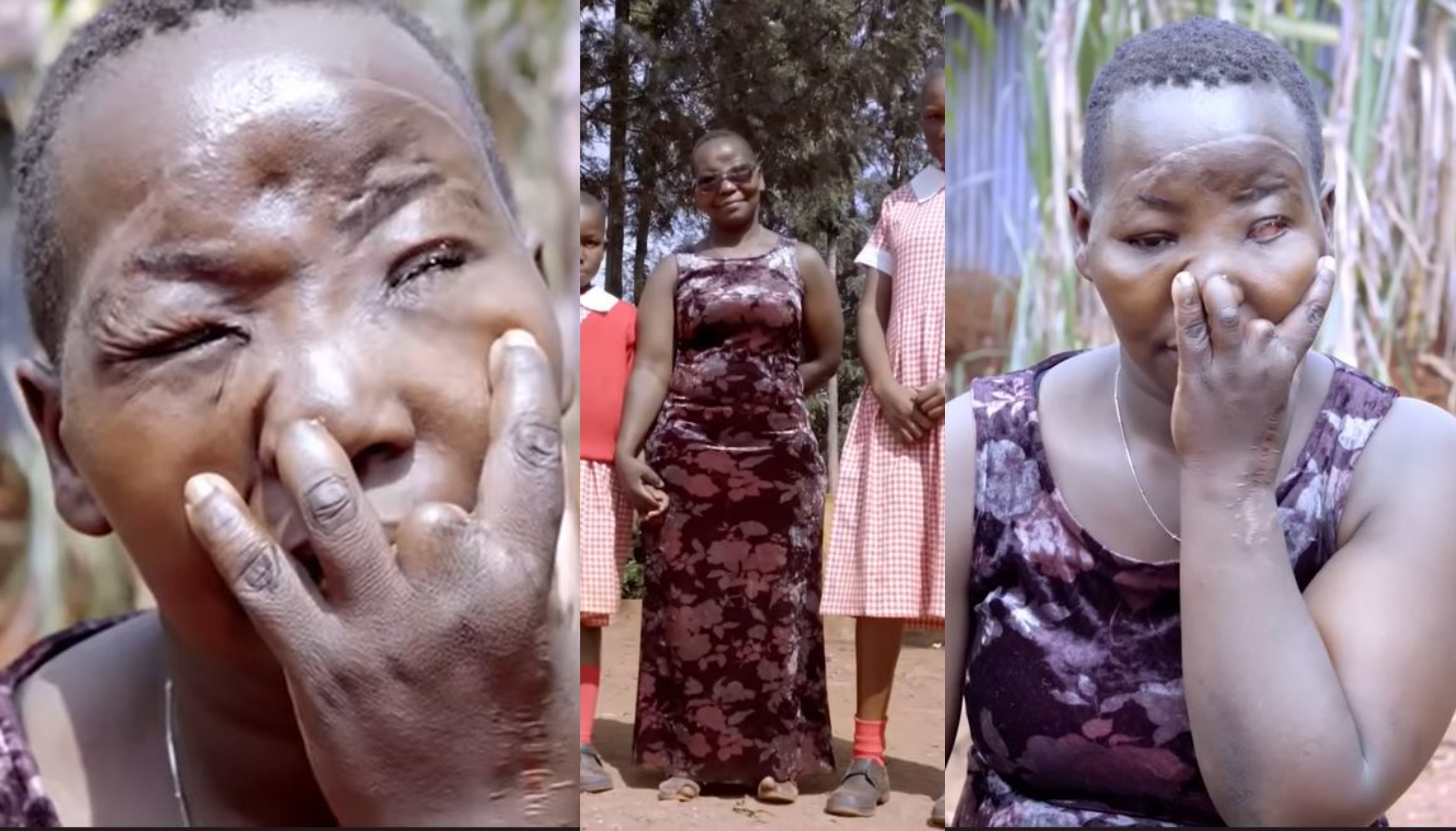 My jealous husband removed my eye, cut off my fingers – Woman narrates (video)