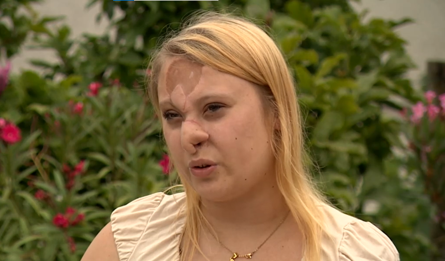 Ramóna orrát leharapta egy kutya, a szíve is leállt, újra kellett éleszteni: „Kiszálltam a testemből, és ott álltam anyáék mellett” – videó