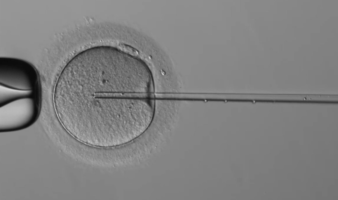 Megszülettek az első &quot;spermarobottal fogant” babák: szabadalmaztatnák a gyerekcsinálást