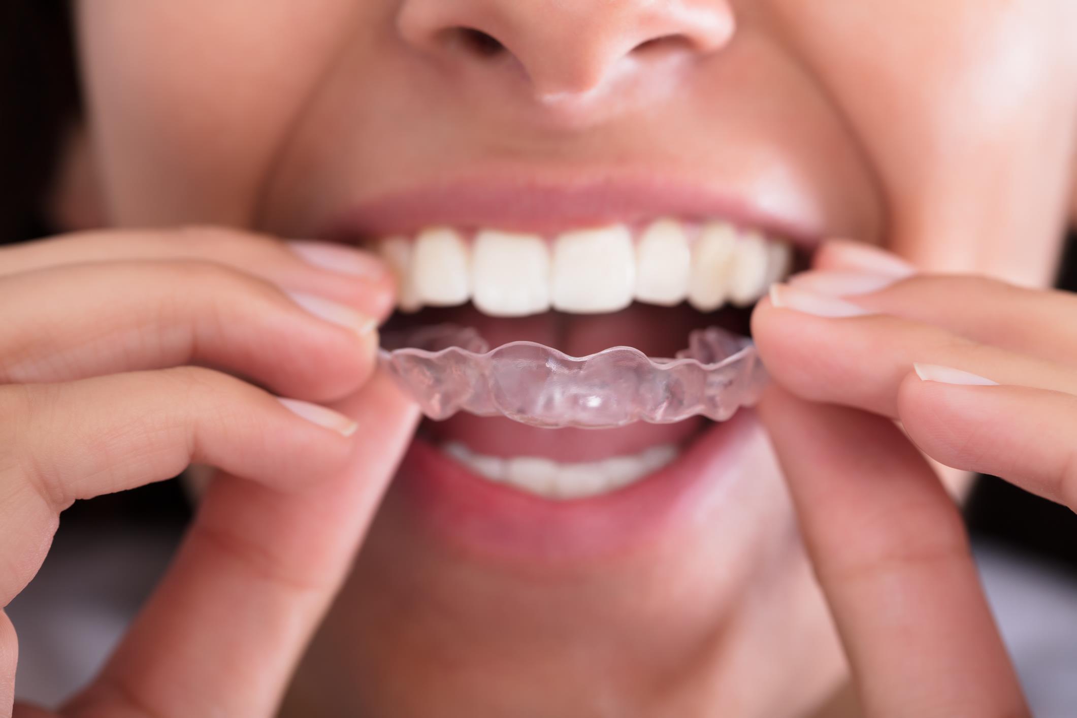 Bruksizm Zgrzytanie Zębami W Nocy Objawy Leczenie 4274