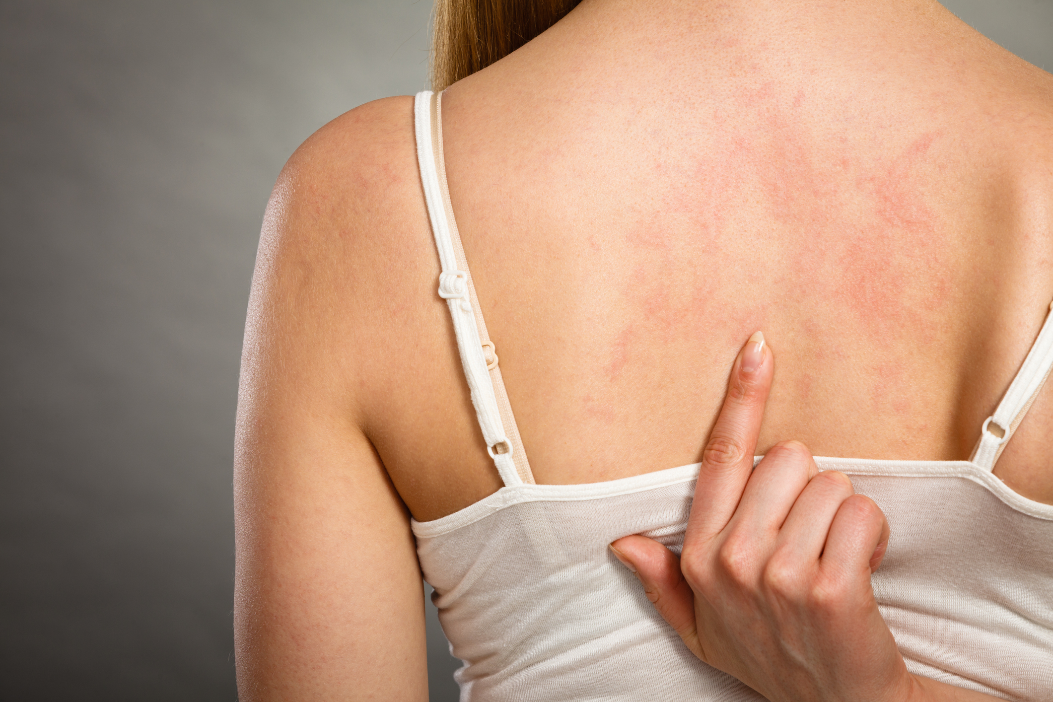 bőr allergia lelki oka