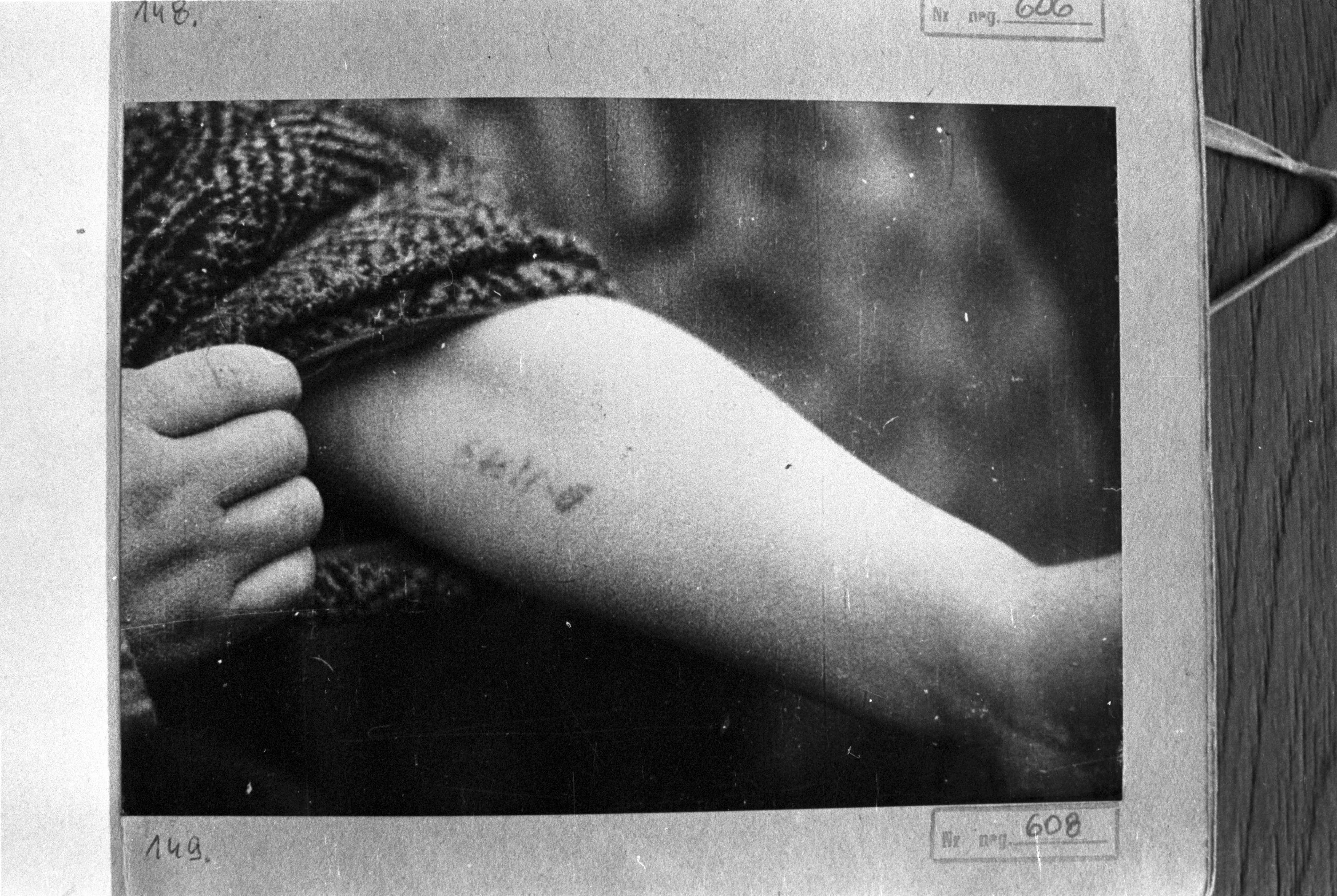 Numer obozowy wytatuowany na ręce, zbiory Państwowego Muzeum Auschwitz-Birkenau Oświęcim