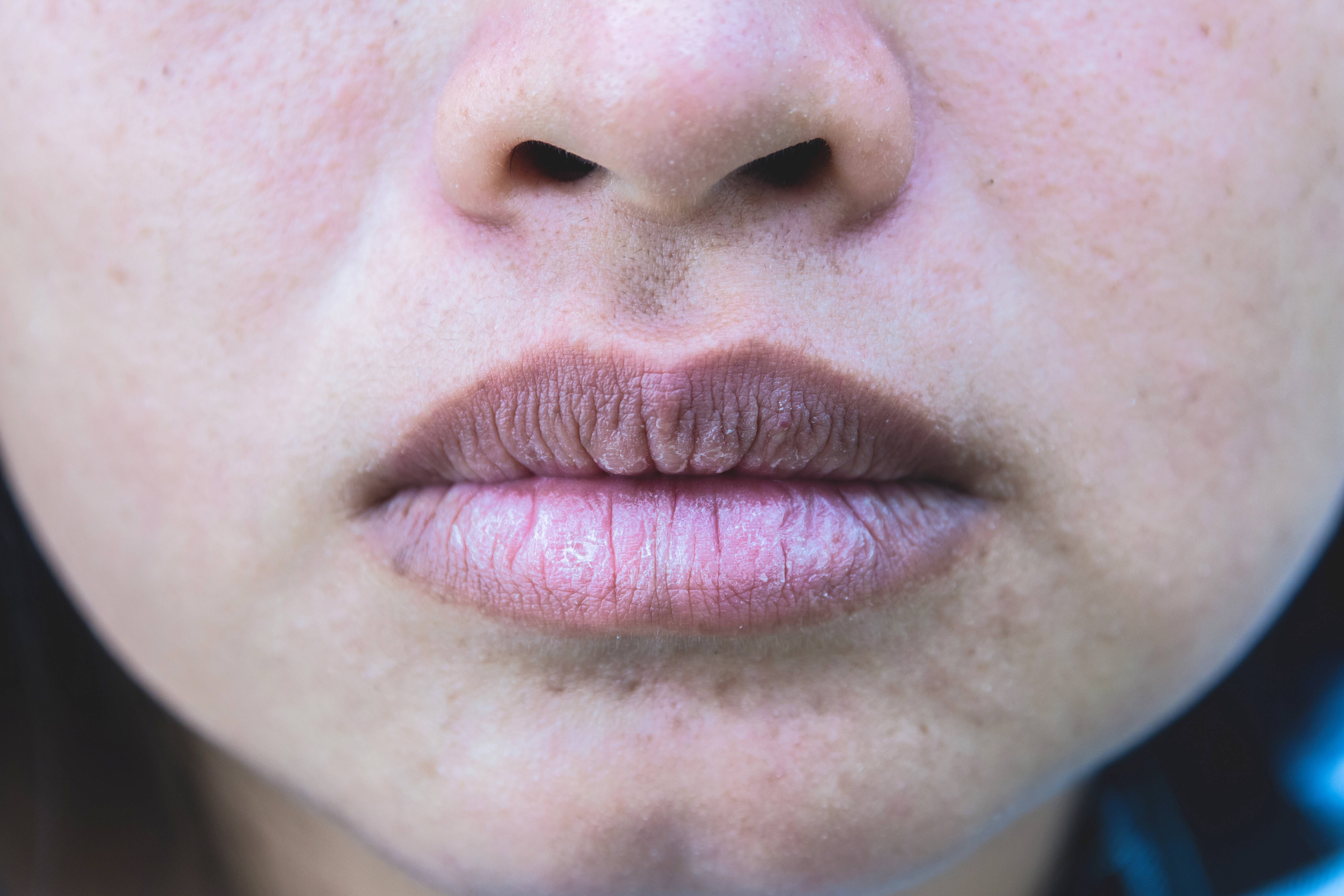 Das verraten Ihre Lippen über Ihre Gesundheit | Vayamo