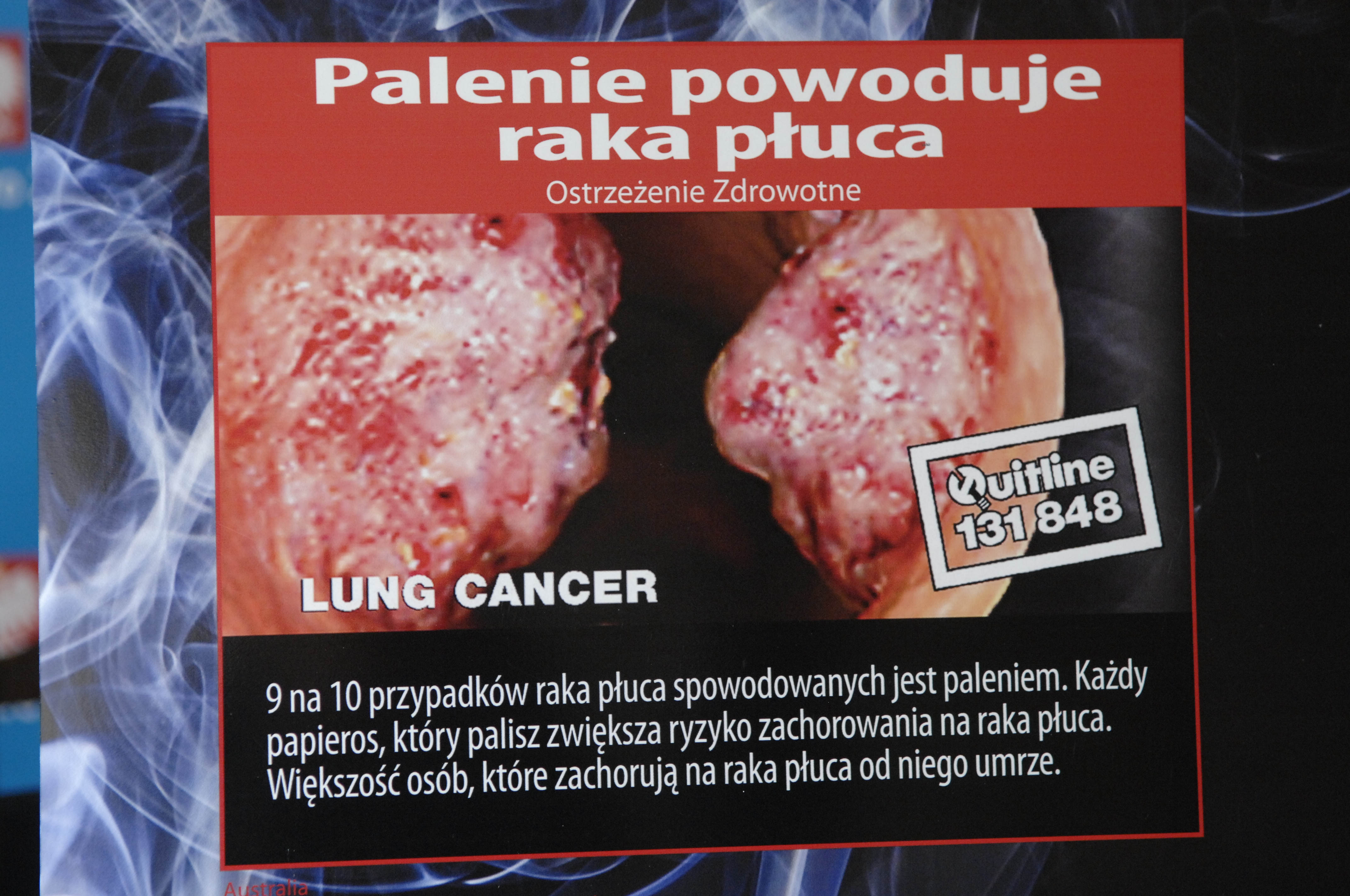 Z okazji Światowego Dnia Bez Tytoniu ministerstwo zdrowia zorganizowało wystawę grafik, jakie w różnych krajach straszą z paczek papierosów