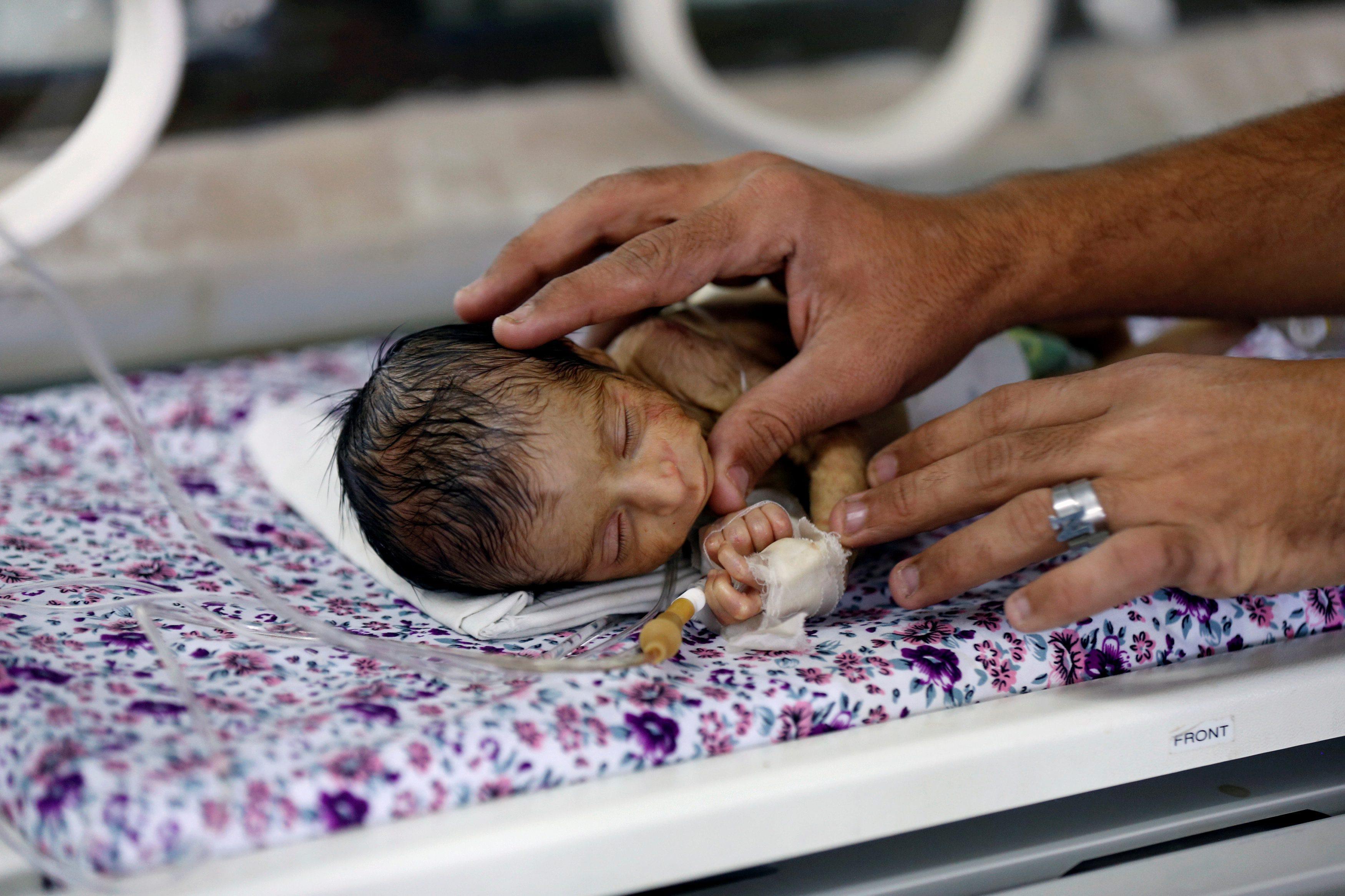 Nurse checks a premature baby in an incubator at the child care unit of a hospital in Sanaa, Yemen