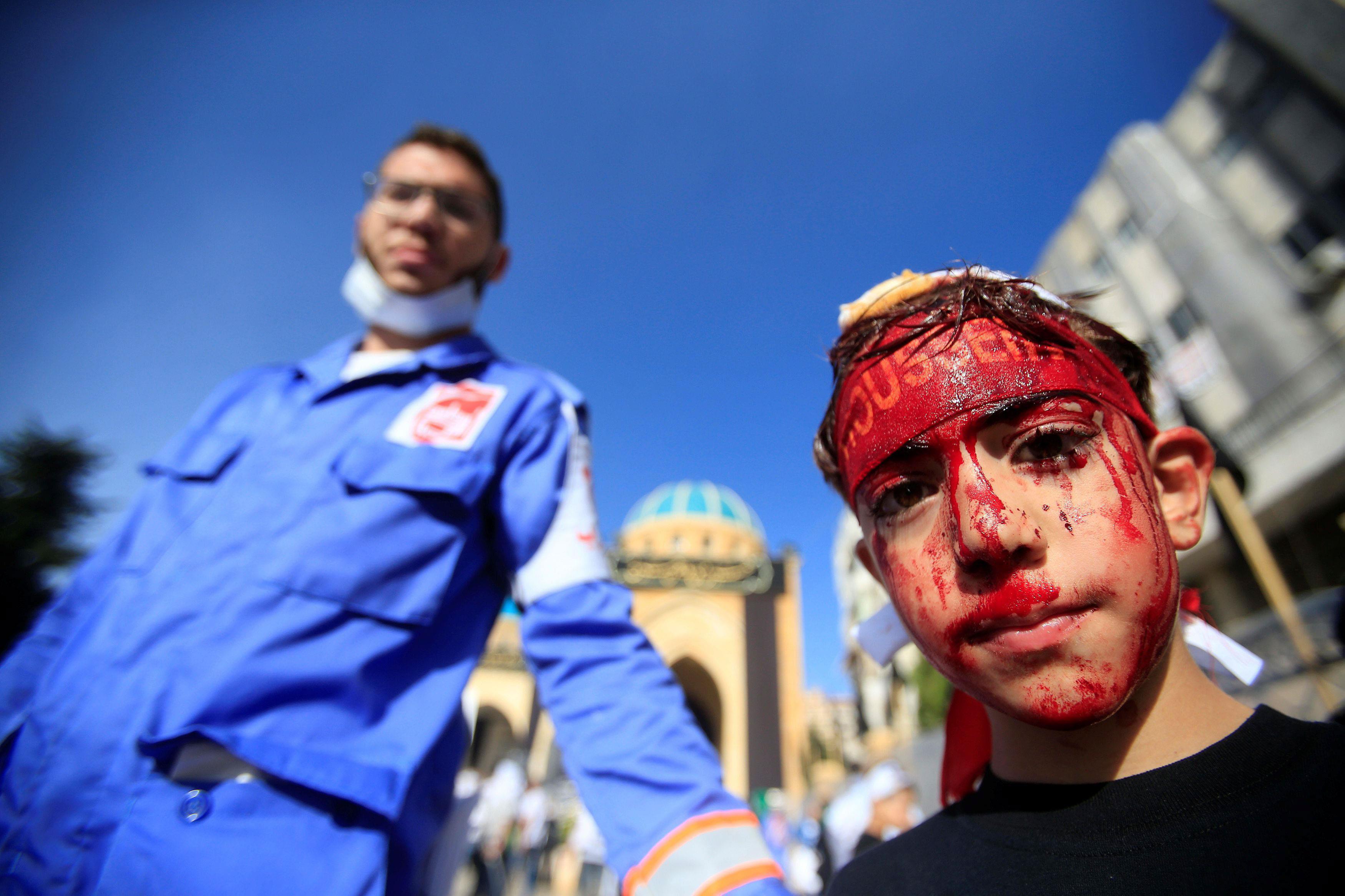 A medic stands near a Shi'ite Muslim boy with his face covered in blood after he was cut on the fore