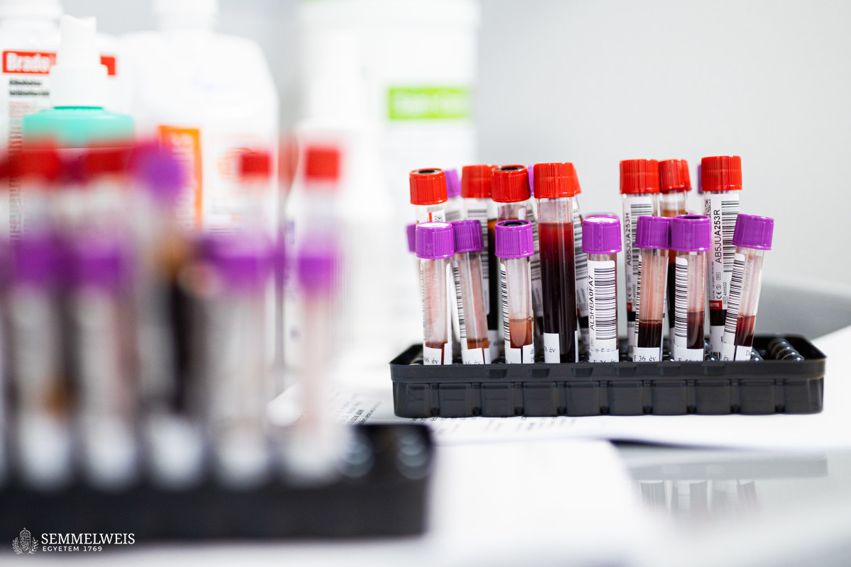 Egy vérvétel is elegendő a szívtranszplantáltak állapotának nyomon követésére