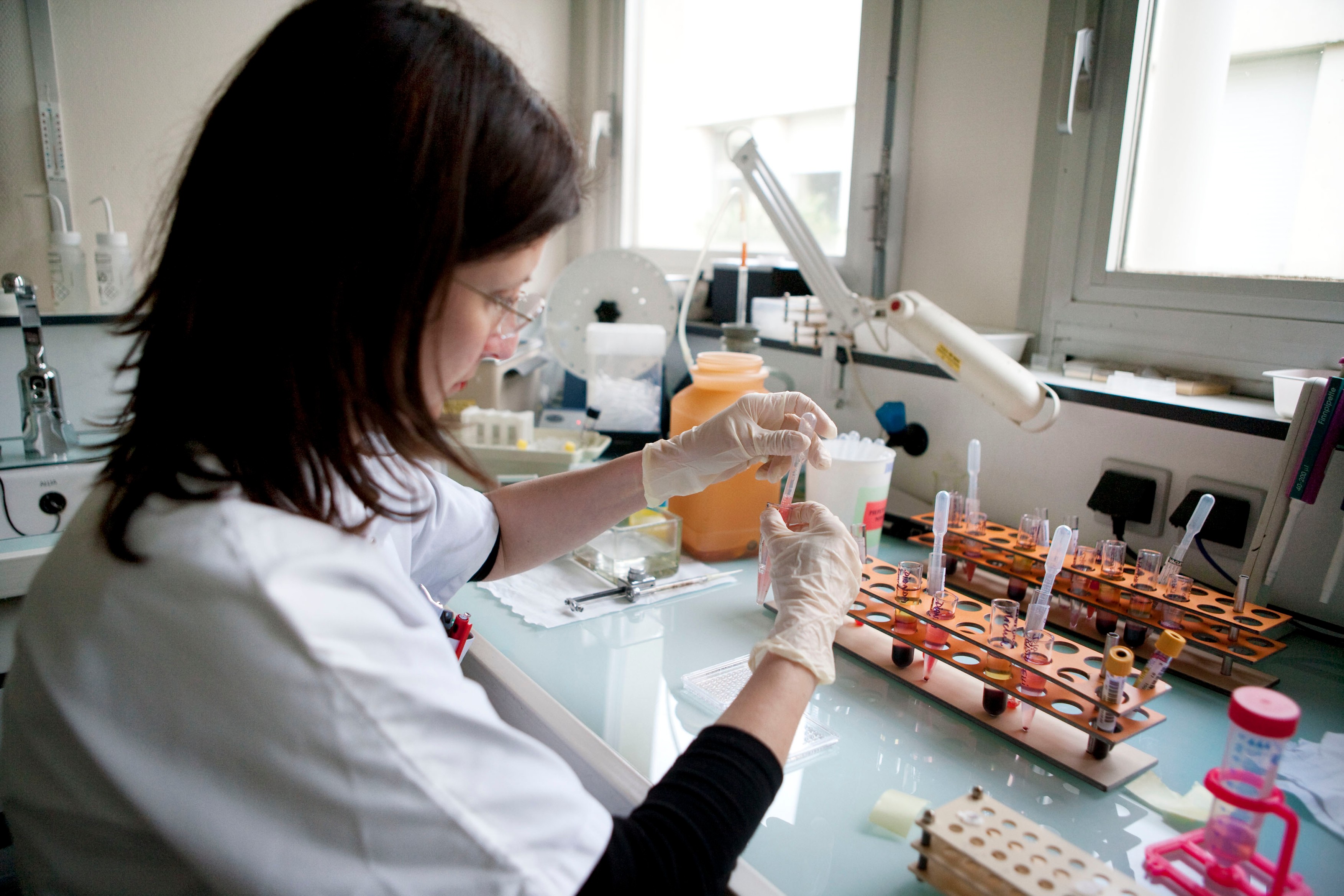 Ddimer ukazuje na trombozu Ko treba da ga radi i koliko često Žena.rs