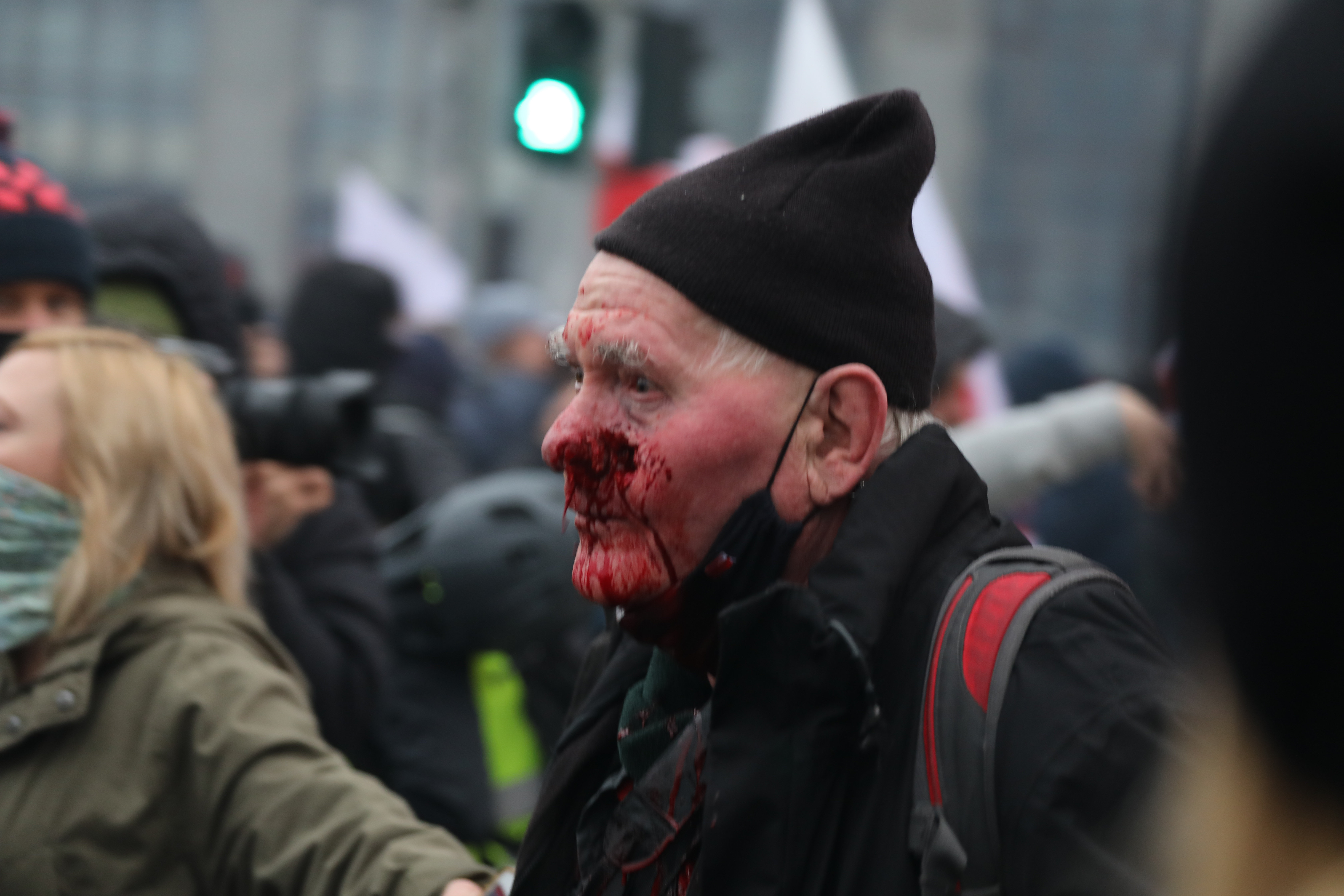 Tomasz Gutry, fotoreporter Tygodnika Solidarność postrzelony gumową kulą