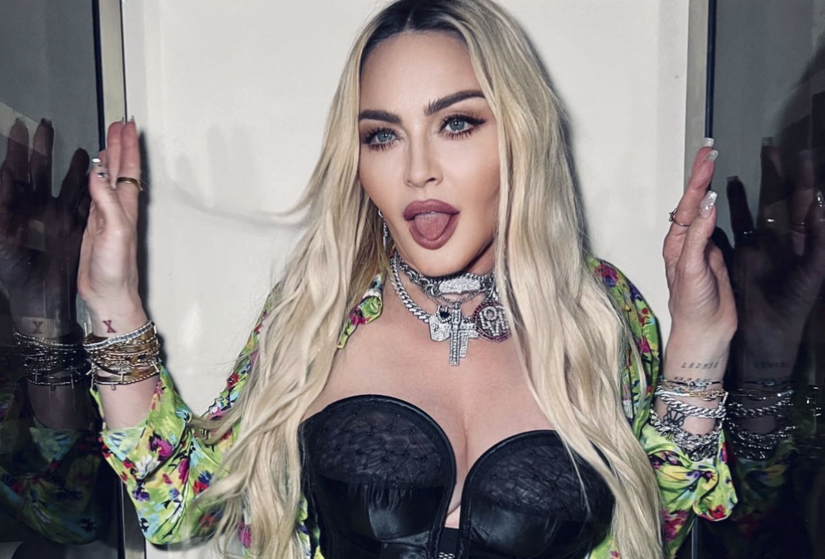 Emberi roncsként készül a visszatérésre Madonna - fotókon, ahogy a kulisszák mögött kezelik a popkirálynőt