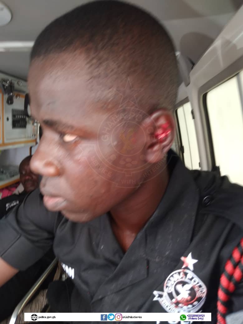 Arise Ghana protesters attacked our personnel with stones - Ghana Police Service